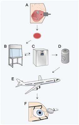 Concise Review: Considering Optimal Temperature for Short-Term Storage of Epithelial Cells